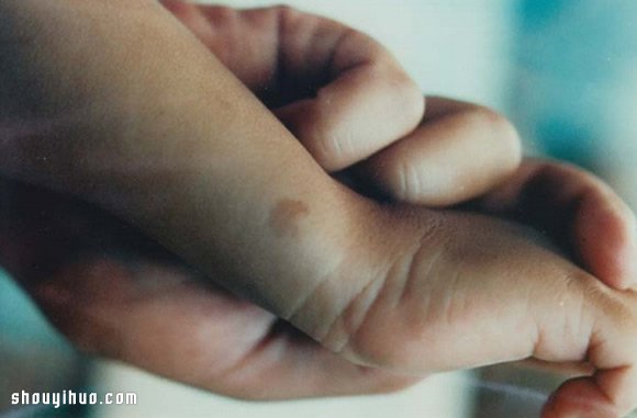 保有前世回憶胎記 7個(gè)輪回轉(zhuǎn)世故事 -  itrip.net.cn
